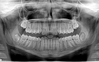3D-Radiologie