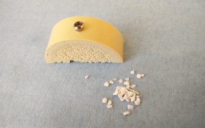 Implant ve Implant fiyatları
